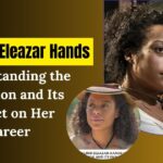 Rosalind Eleazar Hands: Understanding the Condition and Its Impact on Her Career